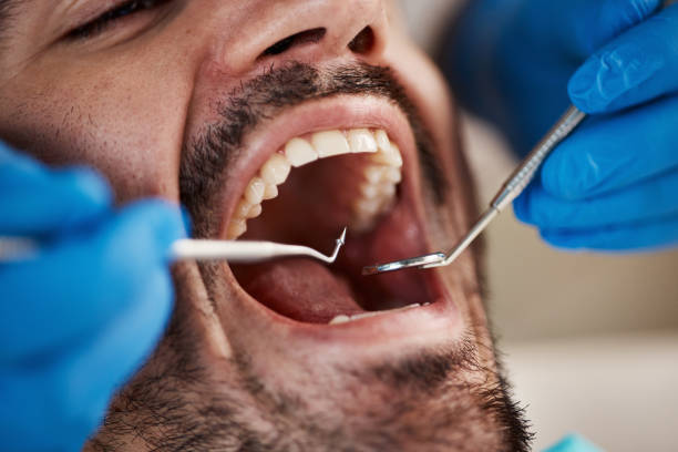 Best Broken Tooth Emergency  in Rantoul, IL