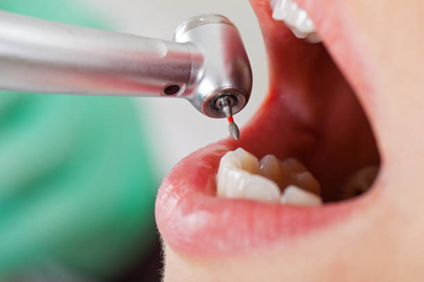 Best Urgent Tooth Repair  in Rantoul, IL
